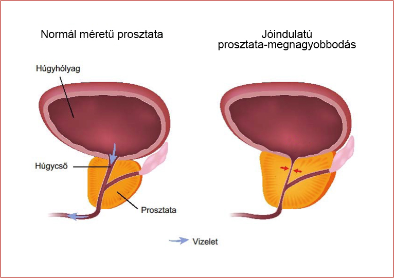 vizelés normális gyakorisága